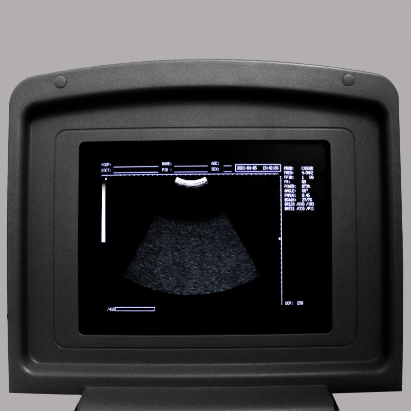 УЗИ сканер Med-Mos CMS600B3