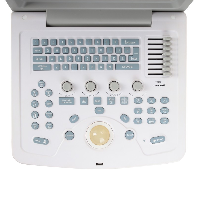 УЗИ сканер Med-Mos CMS600B3