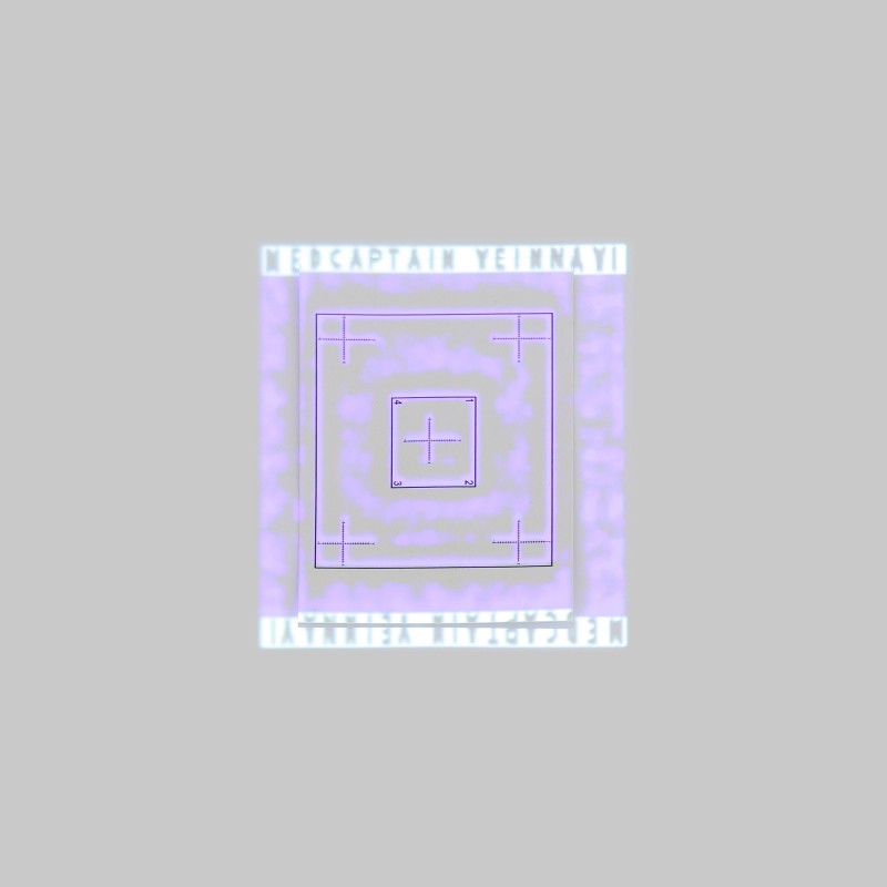 Аппарат визуализации вен проекционный NAVI-60