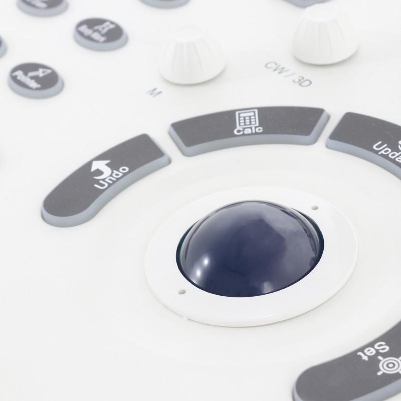 Аппарат ультразвуковой диагностики Med-Mos ЕМР3000 два датчика (Линейный,Конвексный)