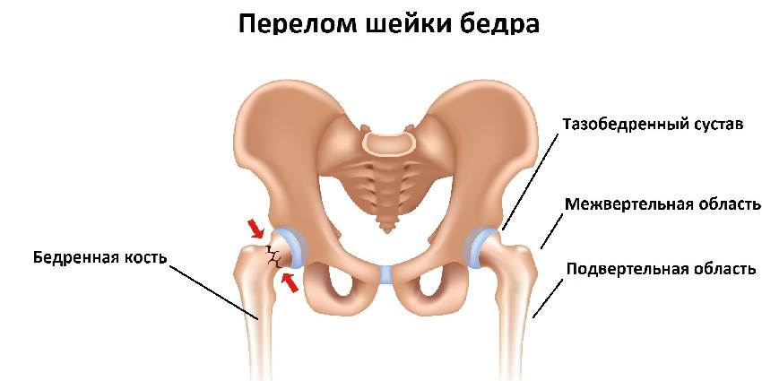 Показать на скелете шейку бедра